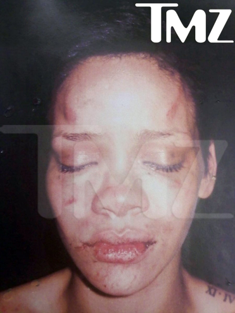 rihanna pictures beat up. Rihanna is all eaten up,